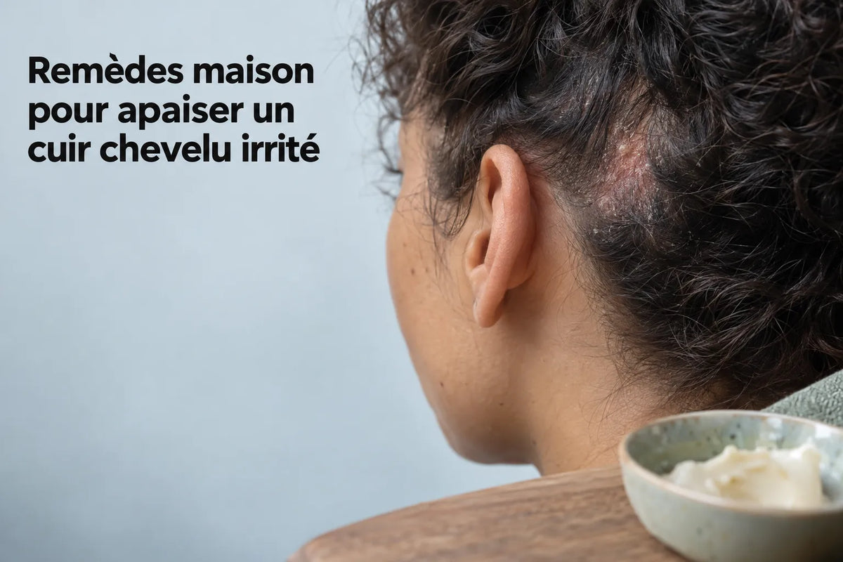 Remèdes maison pour apaiser un cuir chevelu irrité Image